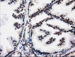 ACY3 Antibody (clone OTI4H7)