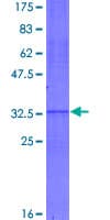 Human SDF1 / CXCL12 Protein (Recombinant GST)