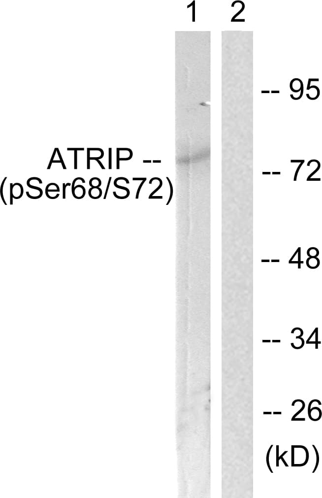 ATRIP Antibody (phospho-Ser68)