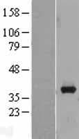 AKR1B10 Protein (Over-Expression Lysate Myc-DDK (Flag))