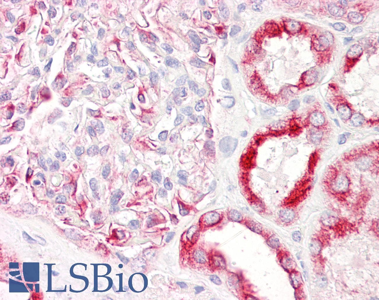 IHC-plus™ PAK1 Antibody (aa178-227)