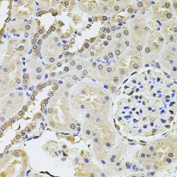 PLK4 / SAK Antibody