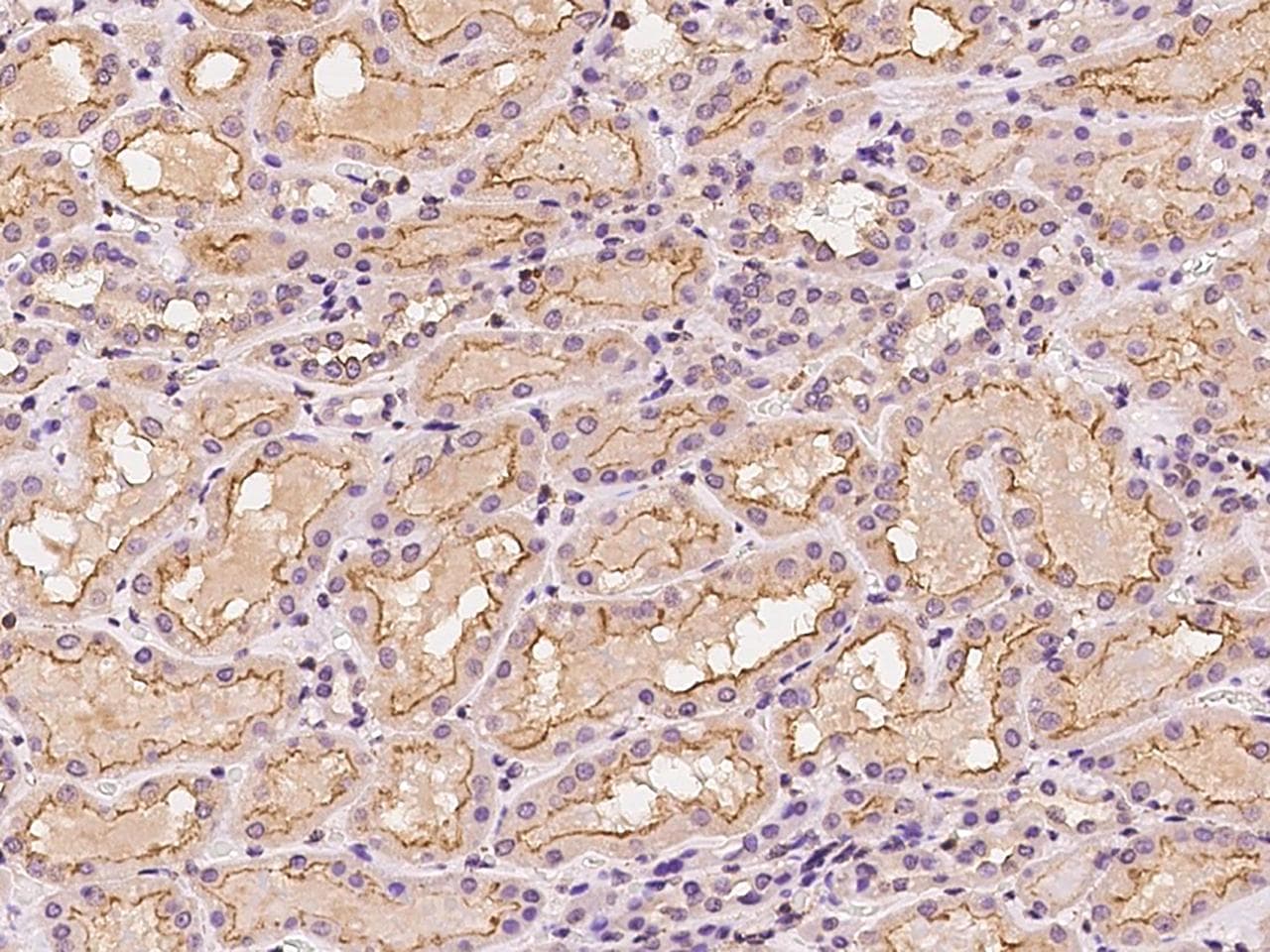 SLC43A1 Antibody