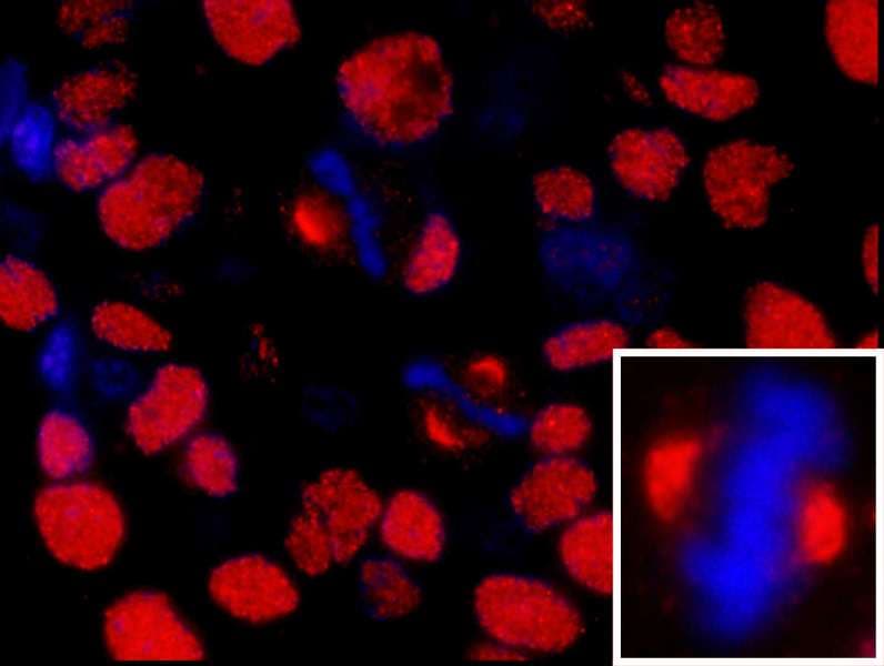 IHC-plus™ Polyclonal Rabbit anti-Human NUMA1 / NUMA Antibody (aa900-950, IHC, IF)