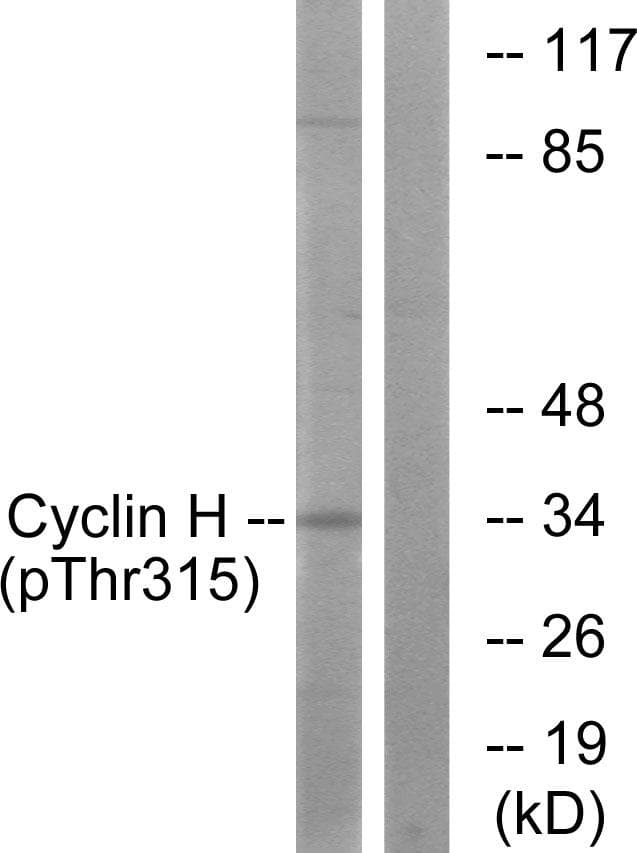 CCNH / Cyclin H Antibody (phospho-Thr315)