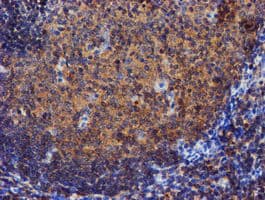 IDS / Iduronate 2 Sulfatase Antibody (clone OTI1D9)