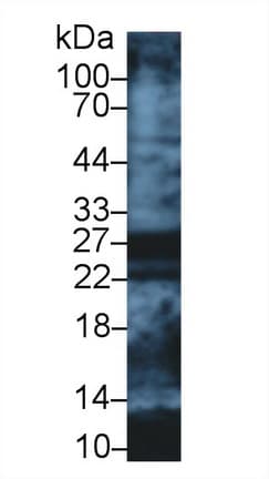 APOA1 / Apolipoprotein A 1 Antibody (aa122-267)