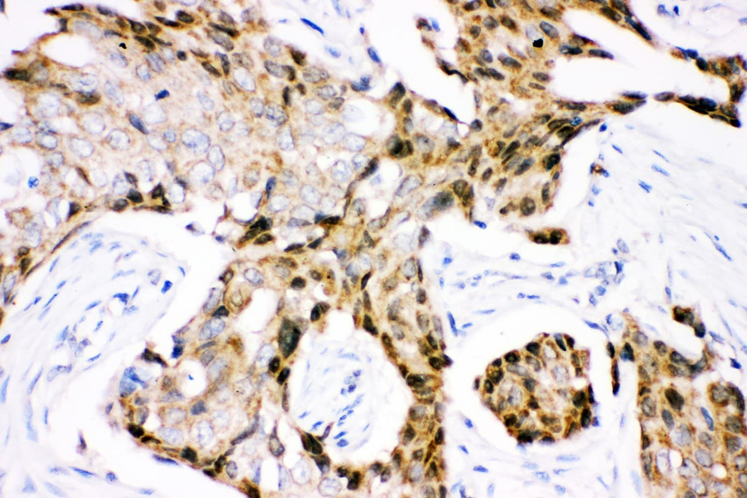 Polyclonal Rabbit anti-Human UBB / Ubiquitin B Antibody (aa77-152, IHC, WB)