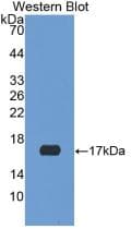 NGB / Neuroglobin Antibody