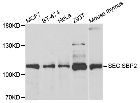 Polyclonal Rabbit anti-Human SECISBP2 / SBP2 Antibody (IHC, IF, WB)