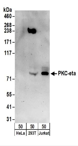 Polyclonal Rabbit anti-Human PRKCH / PKC-Eta Antibody (aa633-683, WB)