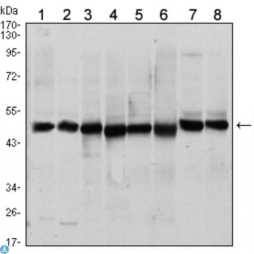 Monoclonal Mouse anti-Human HHIP / HIP Antibody (IHC, IF, WB)