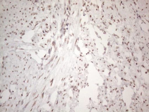 NR2C2 / TAK1 Antibody (aa1-241, clone OTI2H2)