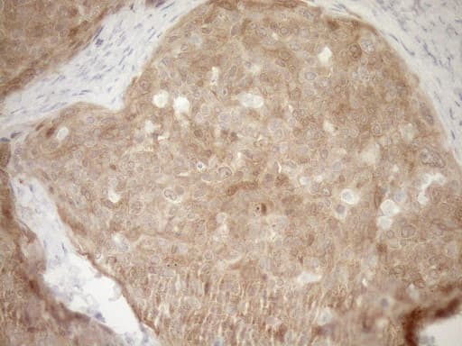 p16INK4a / CDKN2A Antibody (clone OTI7A6)