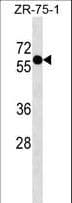 ZNF503 Antibody (aa34-61)