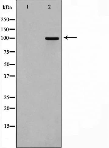 Polyclonal Rabbit anti-Human CSF1R / CD115 / FMS Antibody (IHC, IF, WB)