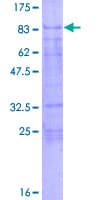 Human KLF11 Protein (Recombinant GST)