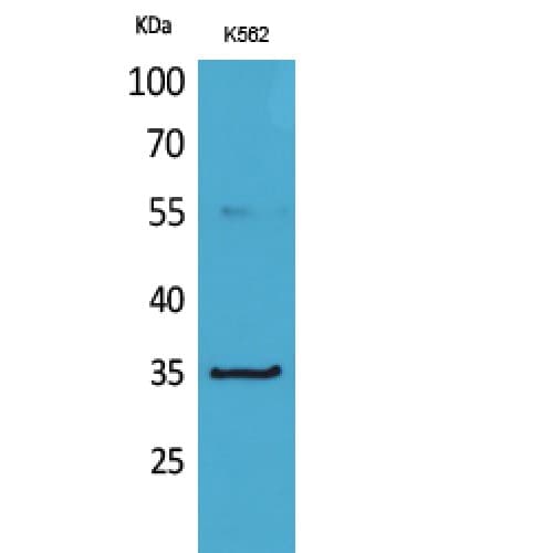 CD32A Antibody (31-80 aa, Internal)