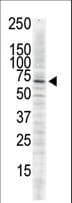 CAMK2D / CaMKII Delta Antibody (aa448-478)