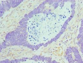 MAD2L1 / MAD2 Antibody (aa1-205)