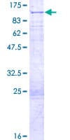 Human VRTN Protein (Recombinant GST)