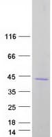 Human SLC30A7 Protein (Recombinant Myc-DDK (Flag))