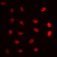 ERCC5 / XPG Antibody (N-Terminus)