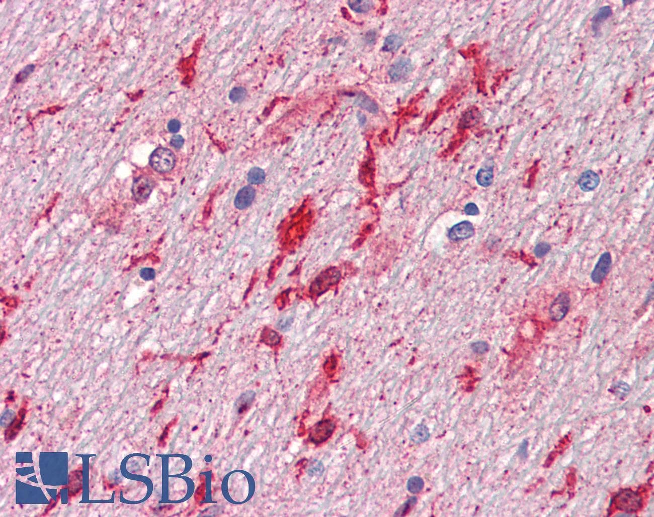 PathPlus™ HGF / Hepatocyte Growth Factor Antibody (clone 7-2)