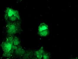 TBCC Antibody (clone OTI2D1)