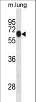 DYRK1B Antibody (aa376-403)