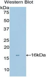 MGP / Matrix Gla-Protein Antibody (aa1-103)
