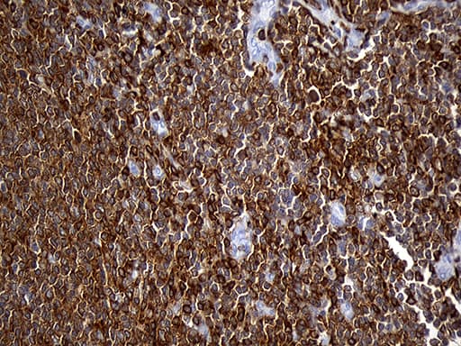 SH3BP1 Antibody (clone OTI1C9)