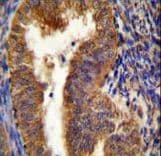 Polyclonal Rabbit anti-Human NIX / BNIP3L Antibody (aa52-81, IHC, IF, WB)