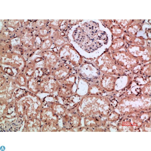 Polyclonal Rabbit anti-Human HMMR / CD168 / RHAMM Antibody (IHC, WB)