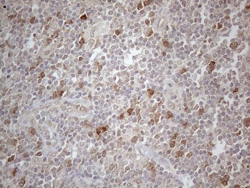 TNFSF5IP1 / CLAST3 Antibody (clone OTI1E8)