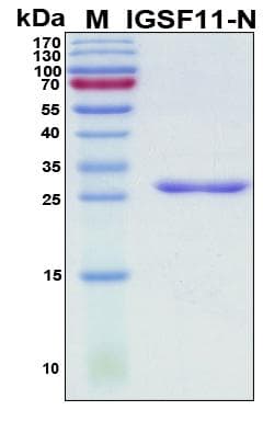 Human IGSF11 / VSIG3 Protein (Recombinant His, N-Terminal)