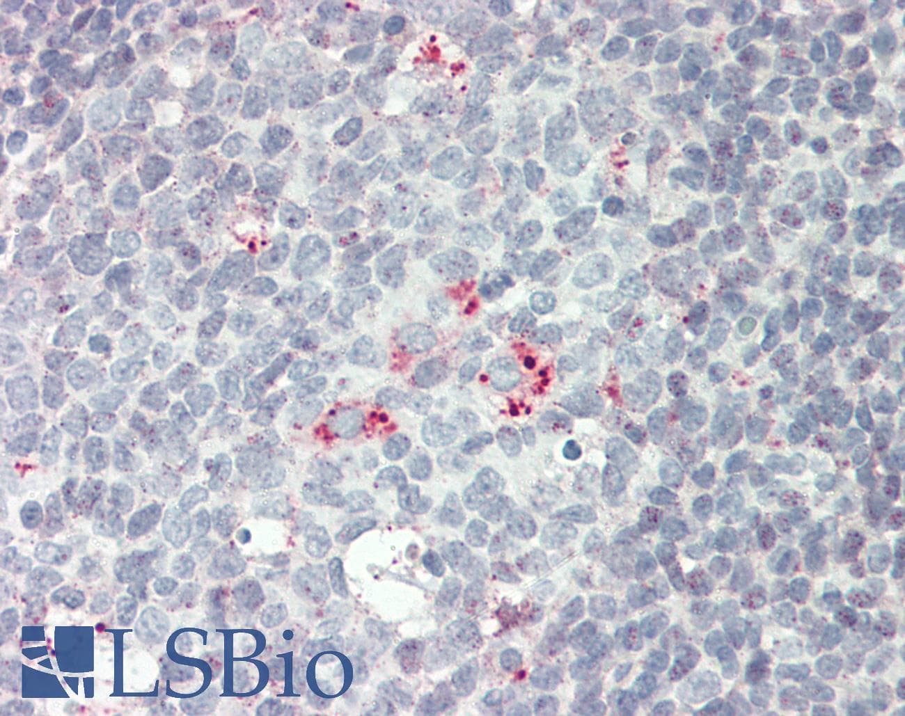 IHC-plus™ Polyclonal Rabbit anti-Human EIF2S1 Antibody (aa60-89, IHC, IF, WB)