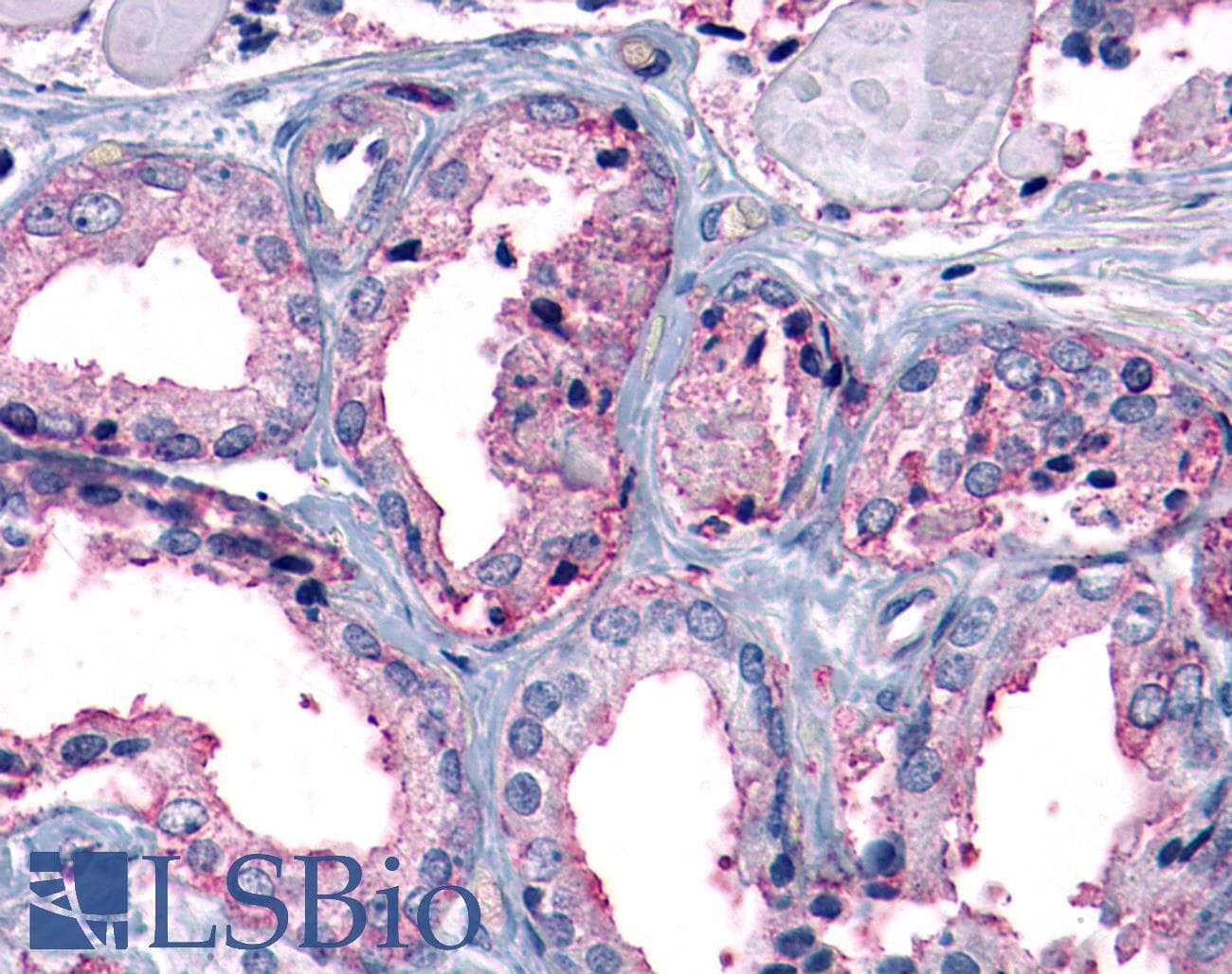 IHC-plus™ MC1R Antibody (Cytoplasmic Domain)