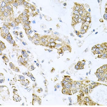Polyclonal Rabbit anti-Human ALKBH8 Antibody (IHC, IF, WB)