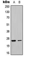 Polyclonal Rabbit anti-Human UBTD1 Antibody (Internal, IHC, WB)