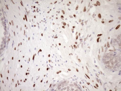 MED15 / ARC105 Antibody (aa393-679, clone OTI1C11)