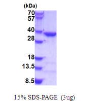 Human COPE Protein (Recombinant His)
