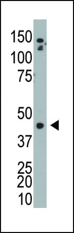 ADK / Adenosine Kinase Antibody (aa35-65)