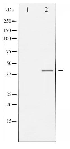 Polyclonal Rabbit anti-Human C/EBP Alpha / CEBPA Antibody (phospho-Ser21, IHC, WB)
