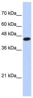 E2F1 Antibody (aa107-156)
