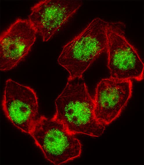 CDKN1C / p57 Kip2 Antibody (aa34-64)