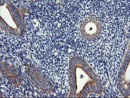 DNM1L / DRP1 Antibody (clone OTI4F6)