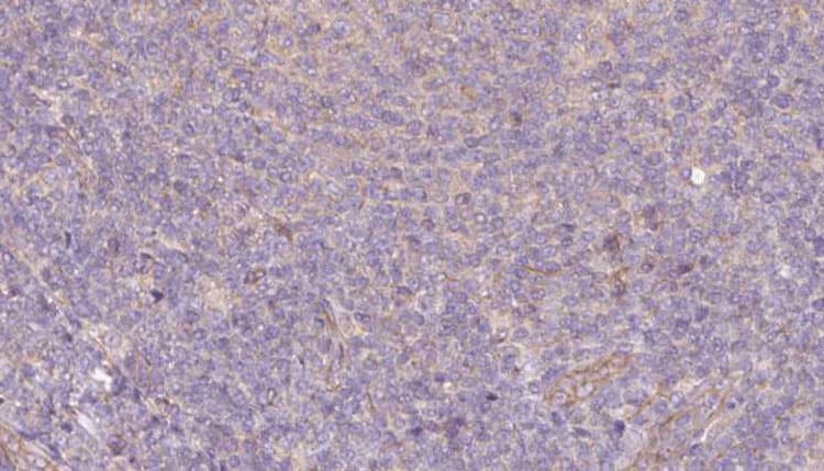 Polyclonal Rabbit anti-Human SEPT9 / Septin 9 Antibody (IHC, IF, WB)