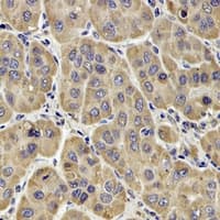 Polyclonal Rabbit anti-Human F13B / TGase Antibody (Internal, IHC, WB)
