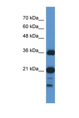 SZRD1 / C1orf144 Antibody (N-Terminus)